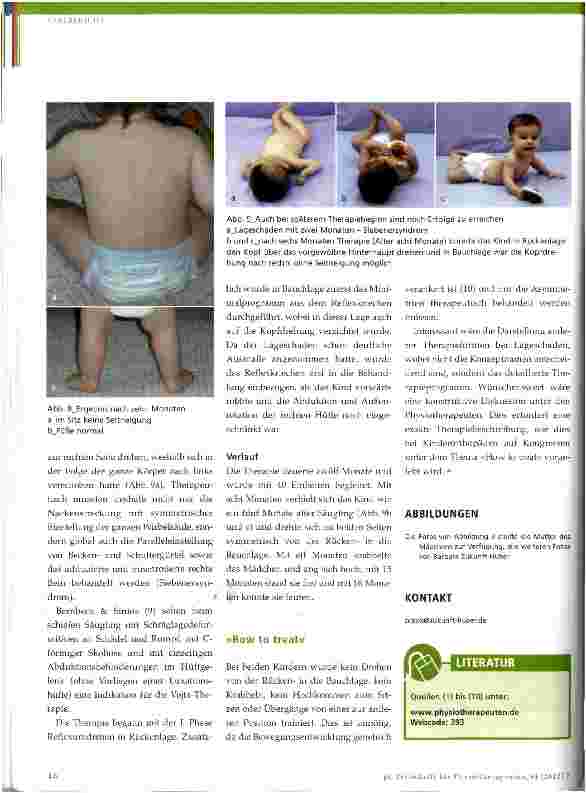 Vorschauseite 5: Physiotherapeutische Behandlung bei Plagiozephalus