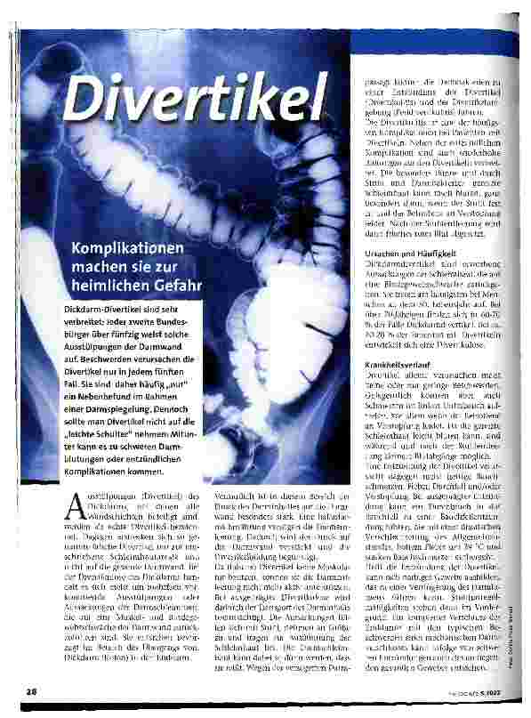 Vorschauseite 1: Divertikel Komplikationen machen sie zur heimlichen Gefahr