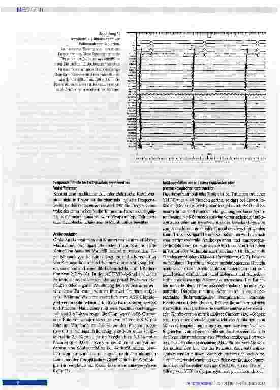 Vorschauseite 2: Vorhofflimmern - Gesichertes und Neues