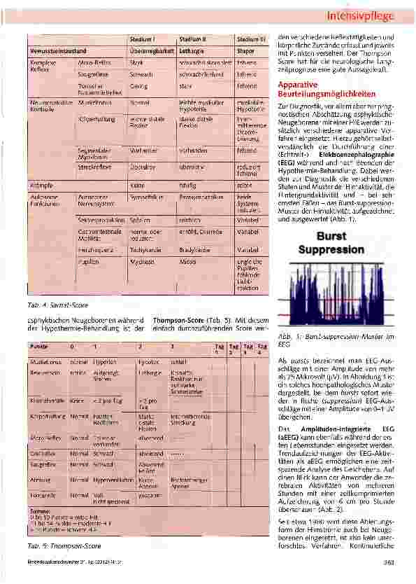 Vorschauseite 5: Die Behandlung der Asphyxie mit HypothermieHohe Anforderung an die Pflegefachkompetenz auf der neonatologischen Intensivstation