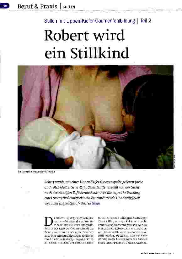 Vorschauseite 1: Stillen mit Lippen-Kiefer-Gaumenfehlbildung | Teil 2 Robert wird ein Stillkind