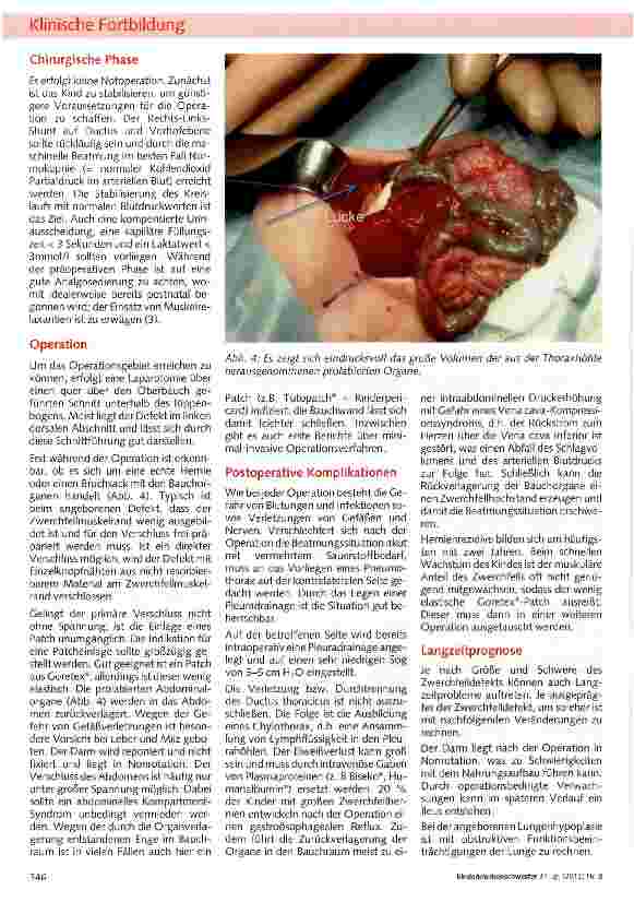 Vorschauseite 5: Die angeborene Zwerchfellhernie
