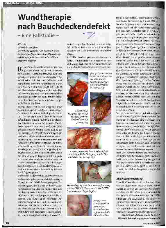 Vorschauseite 1: Wundtherapie nach Bauchdeckendefekt