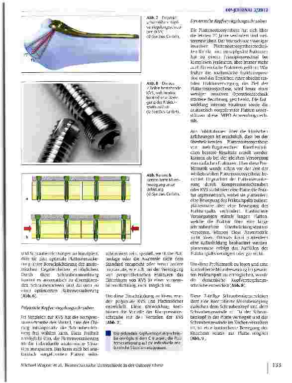 Vorschauseite 4: Biomechanische Unterschiede in der Osteosynthese zwischen Kompressionsplatten und Überbrückungsplatten