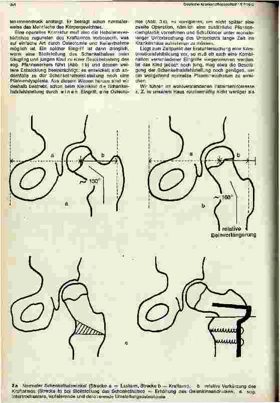 Vorschauseite 3: Die Chirurgie des Hüftgelenks