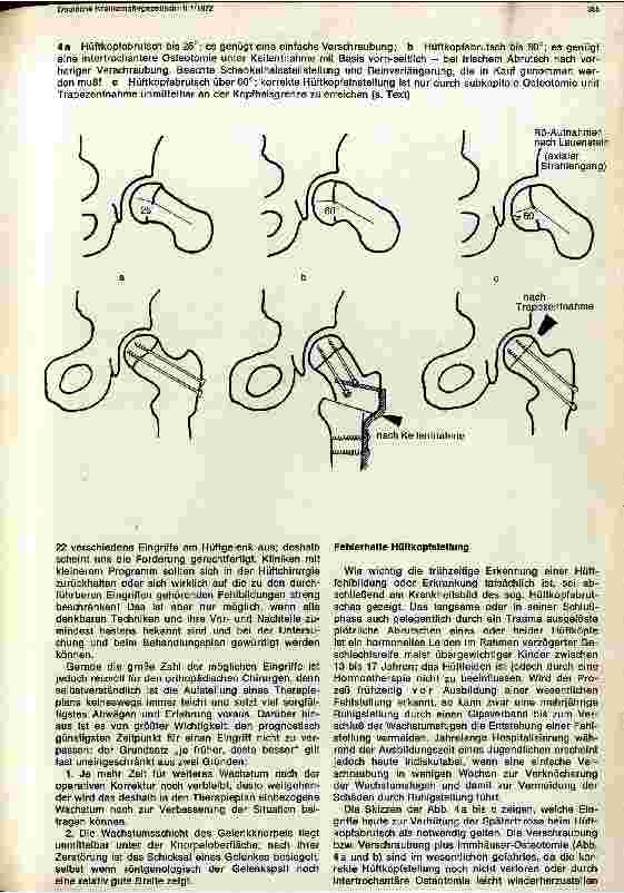 Vorschauseite 4: Die Chirurgie des Hüftgelenks