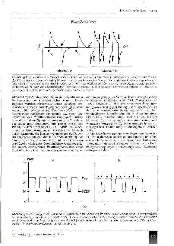 Vorschauseite 6: Moderne Konzepte in der maschinellen Beatmung (CME 11/02)