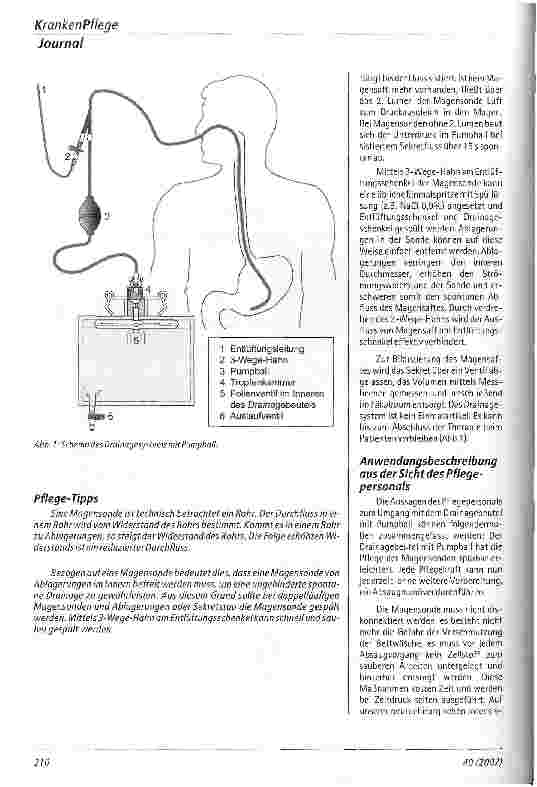 Vorschauseite 2: Drainagebeutel mit Pumpball Ein neues und effektives Hilfsmittel zur verbesserten Pflege von Magensonden