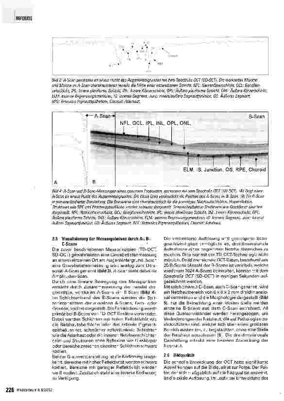 Vorschauseite 4: Geräteübergreifende Analyse von Optischen Kohärenztomographie-B-Scans