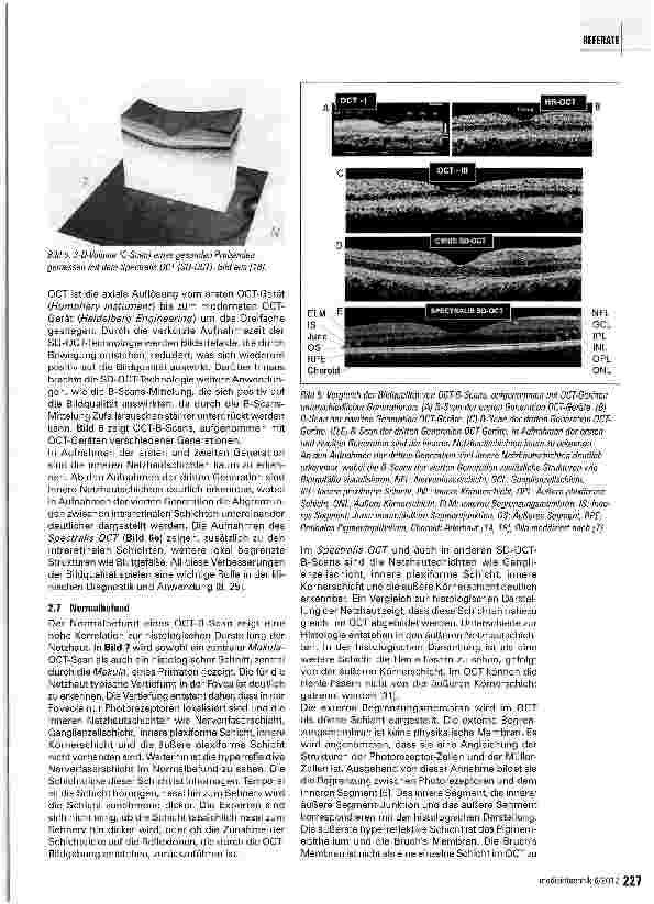Vorschauseite 5: Geräteübergreifende Analyse von Optischen Kohärenztomographie-B-Scans