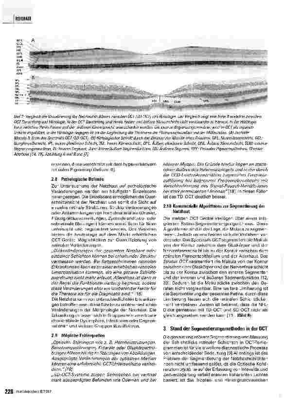 Vorschauseite 6: Geräteübergreifende Analyse von Optischen Kohärenztomographie-B-Scans
