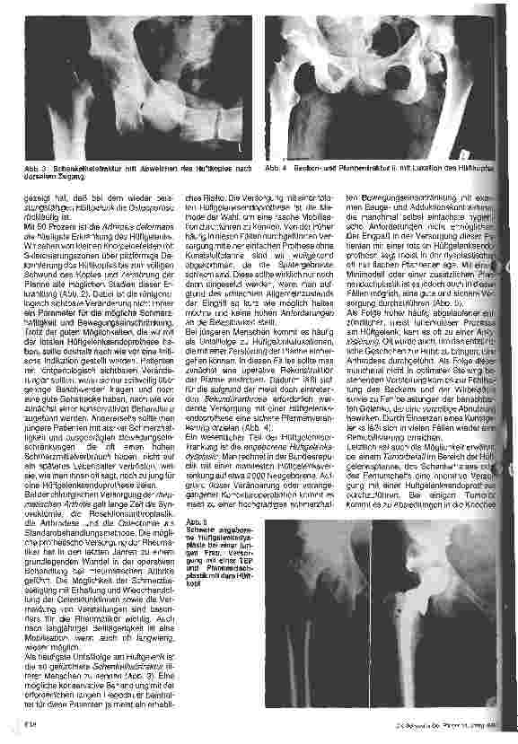 Vorschauseite 2: Möglichkeiten und Indikationen zur Gelenkersatzoperation und ihre Versorgung in der postoperativen Phase