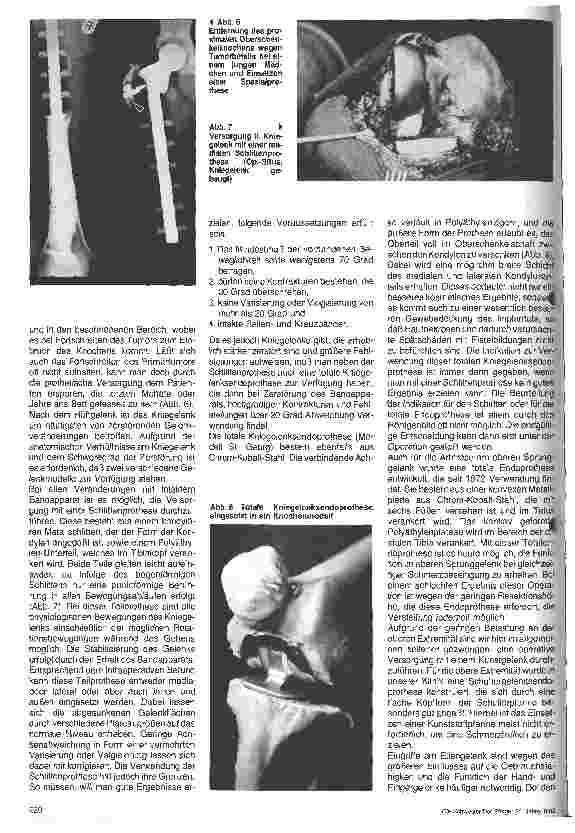 Vorschauseite 3: Möglichkeiten und Indikationen zur Gelenkersatzoperation und ihre Versorgung in der postoperativen Phase