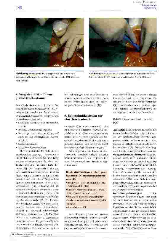 Vorschauseite 4: Tracheotomie
