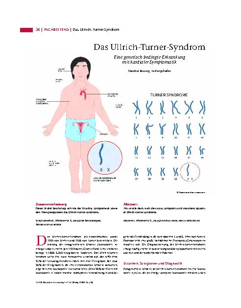 Vorschauseite 1: Das Ullrich-Turner-Syndrom: Eine genetisch bedingte Erkrankung mit kardialer Symptomatik.