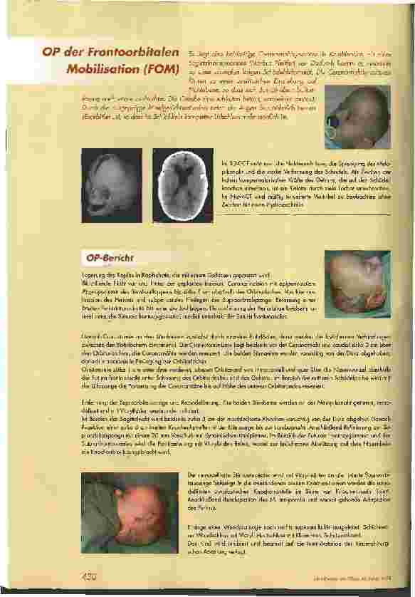 Vorschauseite 3: Pflege eines Kindes nach Craniotomie