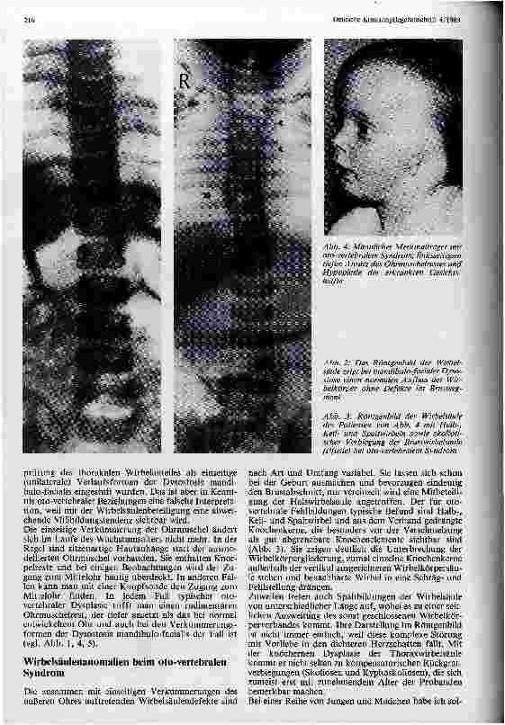 Vorschauseite 2: Angeborene Ohrund Wirbelkörperdysplasien beim oto-vertebralen Syndrom. - Die Kinderkrankenpflege