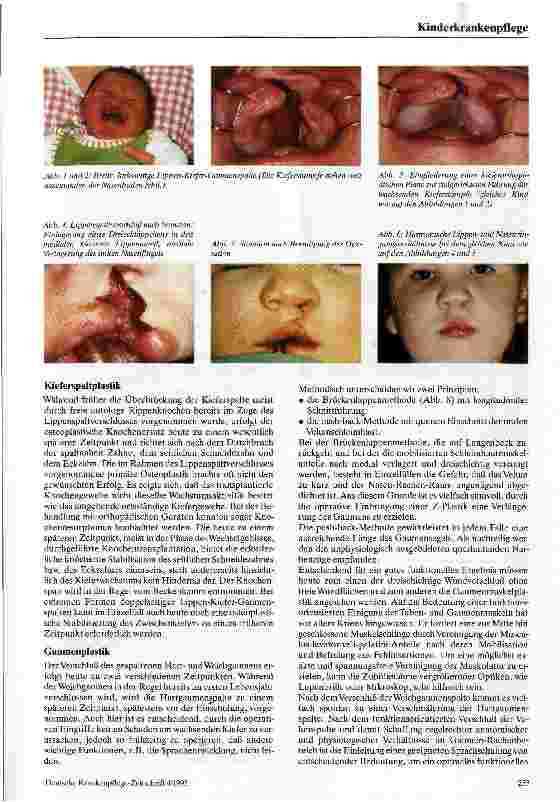 Vorschauseite 2: Die Behandlung von Lippen-Kiefer-Gaumenspalten