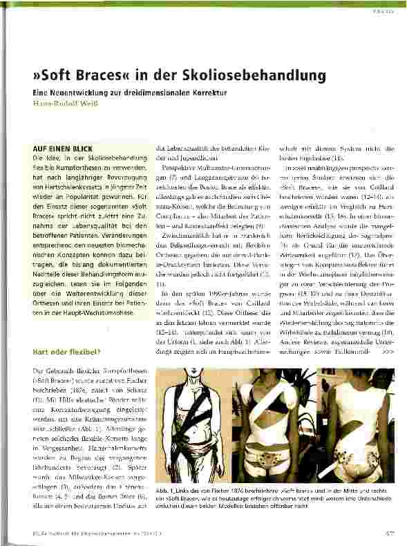 Vorschauseite 1: »Soft Braces« in der Skoliosebehandlung