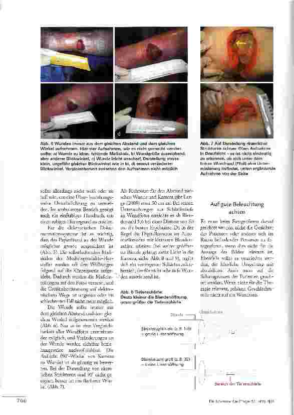 Vorschauseite 5: SO GELINGEN AUSSAGEKRÄFTIGE WUNDFOTOS