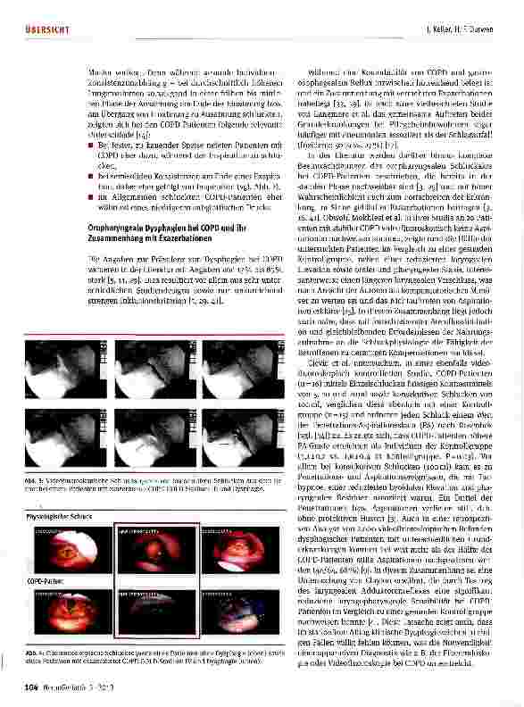 Vorschauseite 4: Dysphagie bei chronisch obstruktiver Lungenerkrankung (COPD) -ein unterschätztes Problem