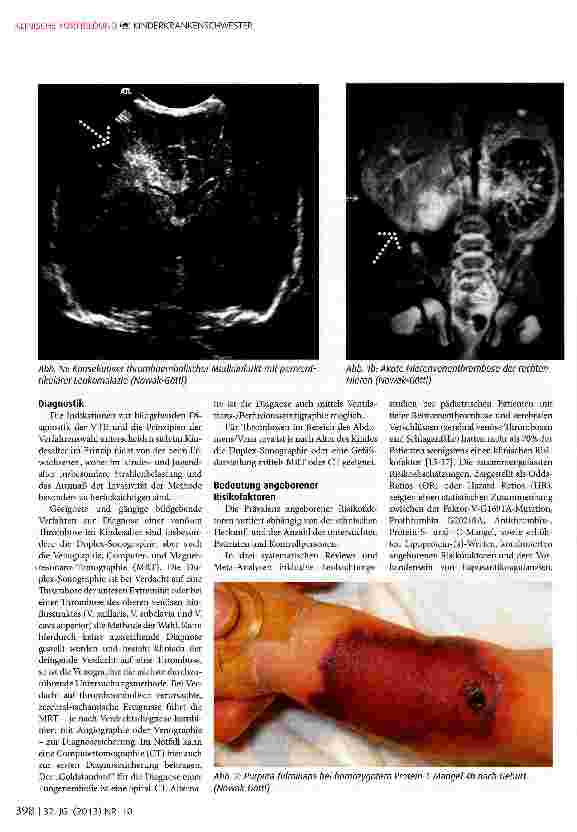 Vorschauseite 3: Thromboembolien im Kindes und Jugendalter