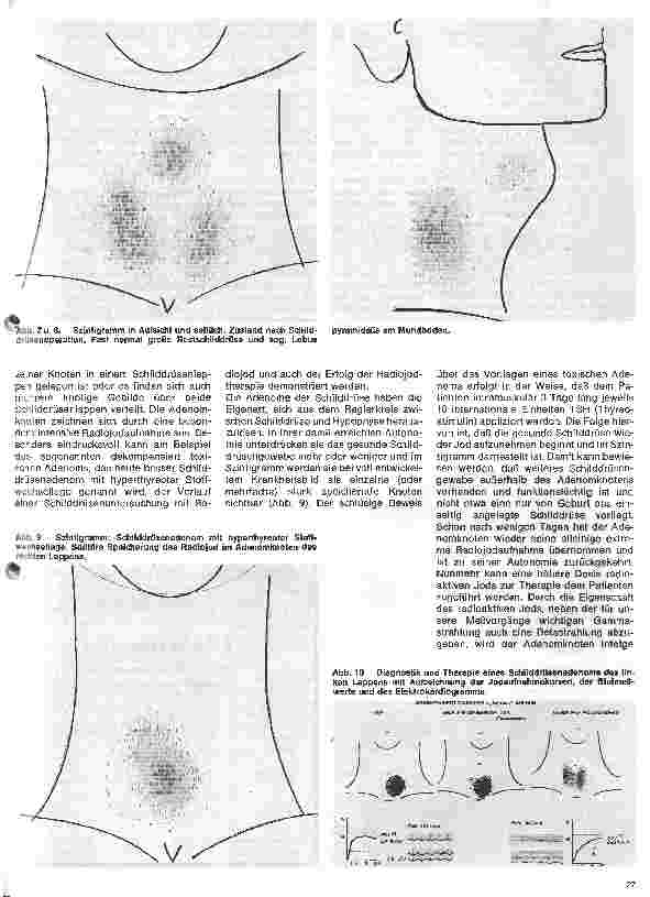 Vorschauseite 4: Radiologie Eine Einführung für Krankenschwestern u. Krankenpfleger 12. Folge: Nuklearmedizinische Untersuchungen der Schilddrüse
