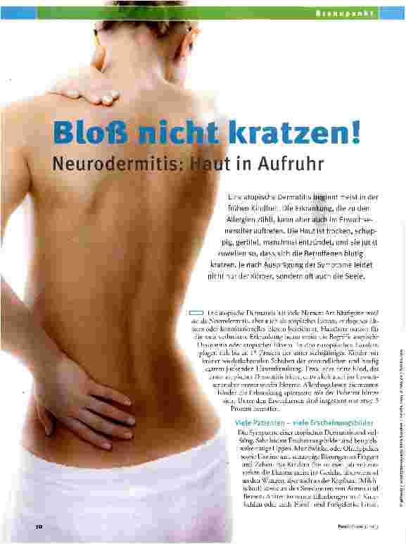 Vorschauseite 1: Bloß nicht kratzen
