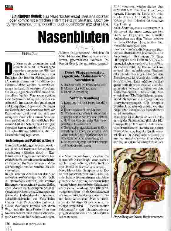 Vorschauseite 1: Nasenbluten Ein häufiger Notfall