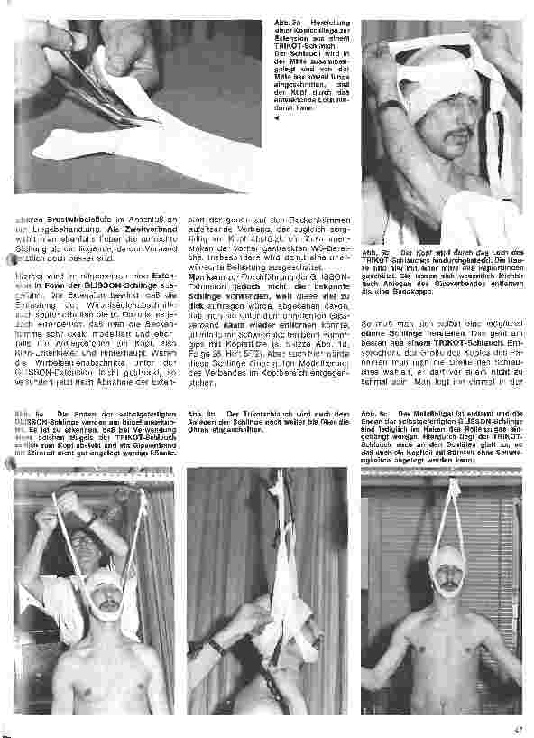 Vorschauseite 4: Grundlagen und Technik des Gipsverbandes 34. Folge: Rumpfgipsverband m. Kopfstütze, Rumpf-Hals-Kopf-Gipsverband, Thorax-Hals-Kopf-Gipsverband