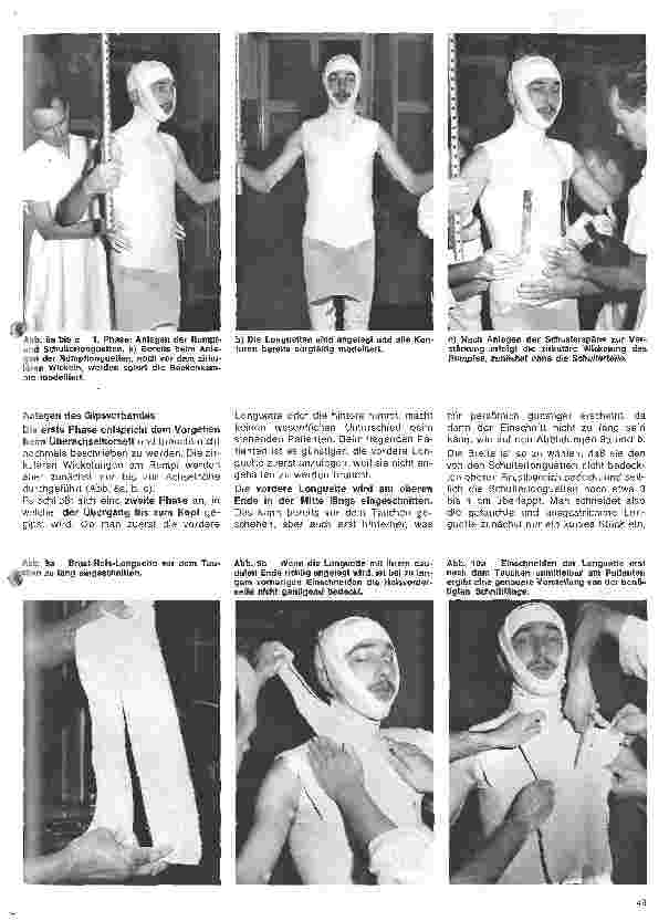 Vorschauseite 6: Grundlagen und Technik des Gipsverbandes 34. Folge: Rumpfgipsverband m. Kopfstütze, Rumpf-Hals-Kopf-Gipsverband, Thorax-Hals-Kopf-Gipsverband