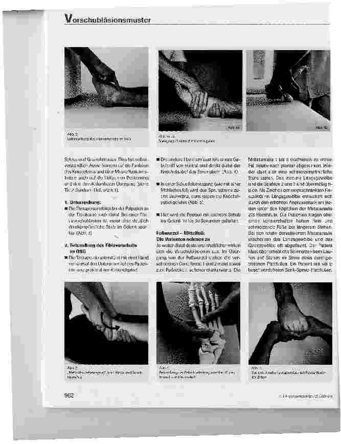 Vorschauseite 3: Vorschubläsionsmuster der unteren Extremität und ihre Behandlung