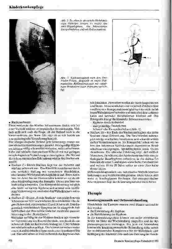 Vorschauseite 2: Der Morbus Scheuermann Diagnostik und Therapie