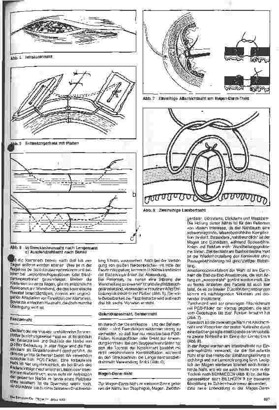 Vorschauseite 2: Nahttechniken und Nahtmaterialien in der Allgemeinchirurgie