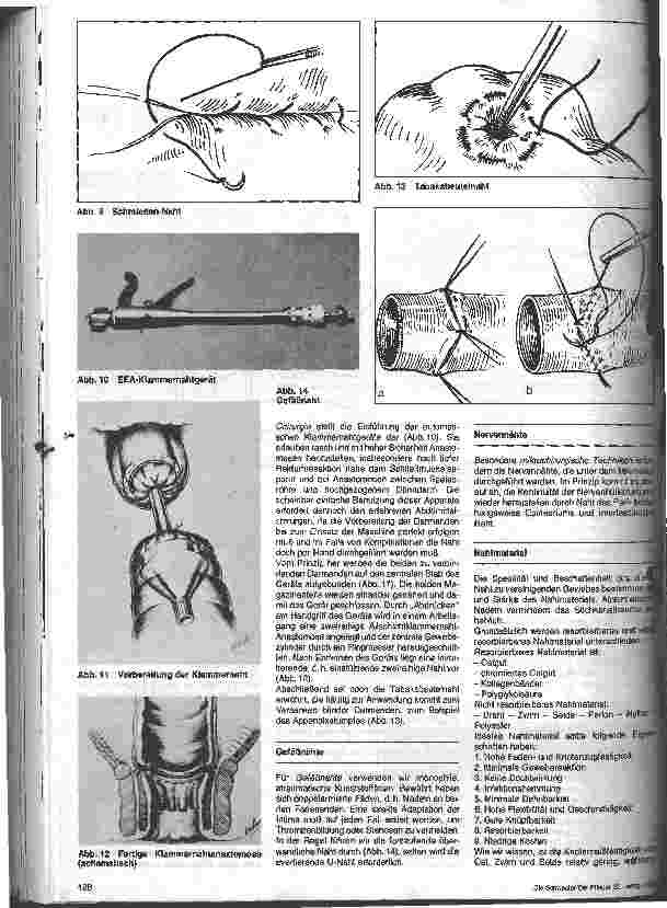 Vorschauseite 3: Nahttechniken und Nahtmaterialien in der Allgemeinchirurgie