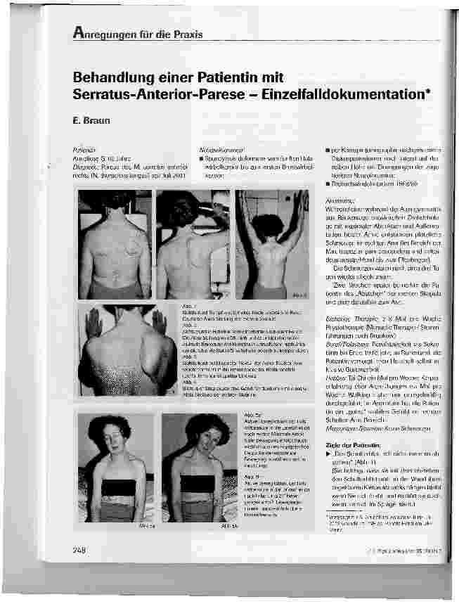 Vorschauseite 1: Behandlung einer Patientin mit Serratus-Anterior-Parese - Einzelfalldokumentation