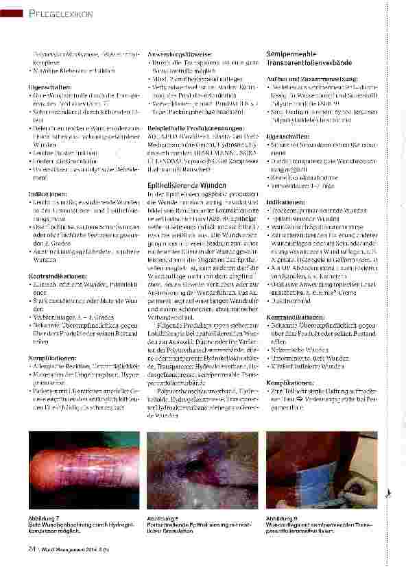 Vorschauseite 4: Versorgungsmöglichkeiten in verschiedenen Wundstadien, Teil 6: Umgang mit granulierenden und epithelisierenden Wunden