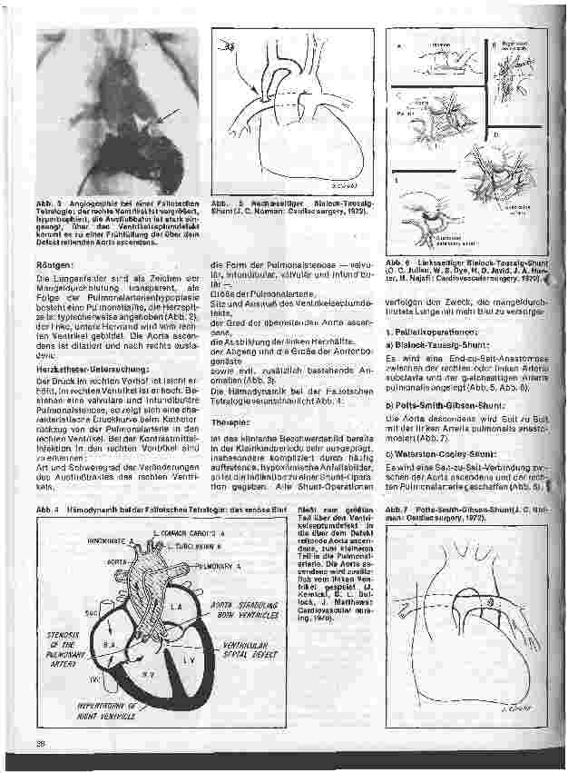 Vorschauseite 2: Das Herz 9. Folge:Angeborene Herzfehler, Klinik u. operative Therapie (II.Teil)