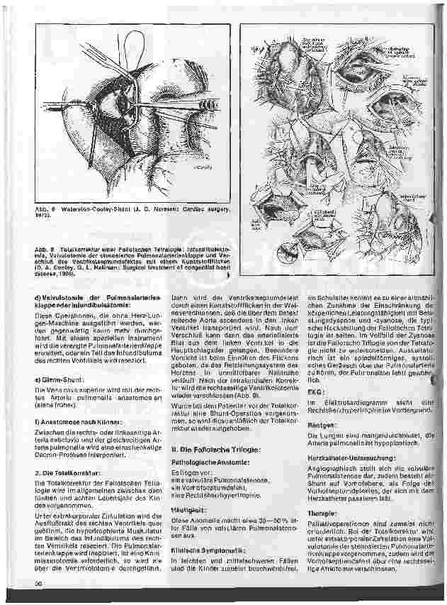 Vorschauseite 3: Das Herz 9. Folge:Angeborene Herzfehler, Klinik u. operative Therapie (II.Teil)