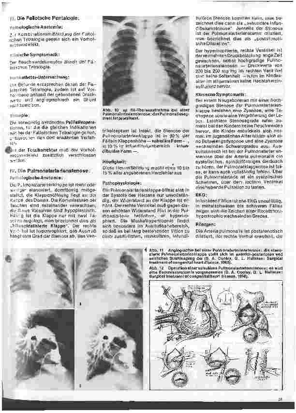 Vorschauseite 4: Das Herz 9. Folge:Angeborene Herzfehler, Klinik u. operative Therapie (II.Teil)