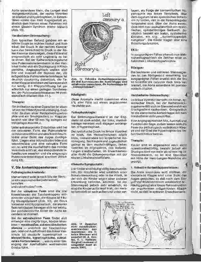 Vorschauseite 5: Das Herz 9. Folge:Angeborene Herzfehler, Klinik u. operative Therapie (II.Teil)