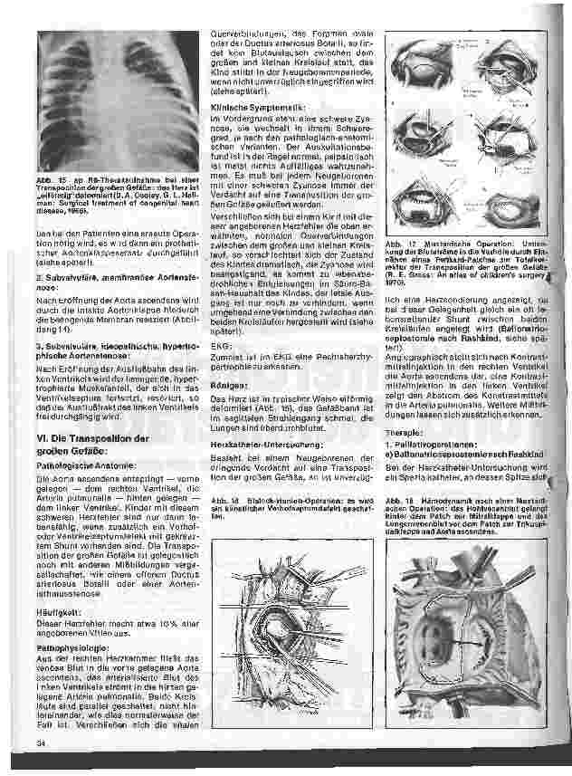 Vorschauseite 6: Das Herz 9. Folge:Angeborene Herzfehler, Klinik u. operative Therapie (II.Teil)