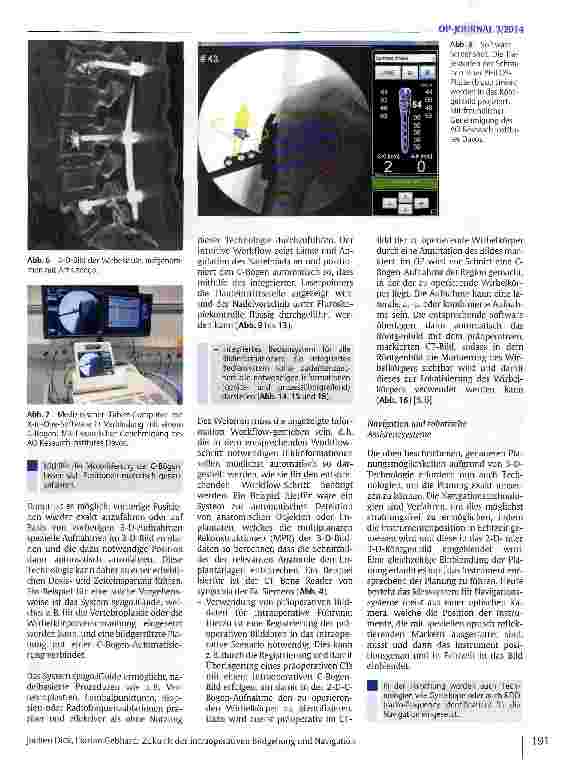 Vorschauseite 4: Zukunft der intraoperativen Bildgebung und Navigation
