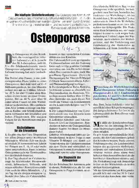 Vorschauseite 1: Osteoporose Die häufigste Skeletterkrankung