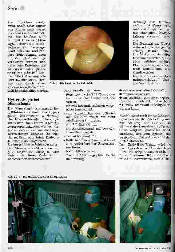 Vorschauseite 3: Minimal-invasive Chirurgie 8. Folge: Die operative Hysteroskopie