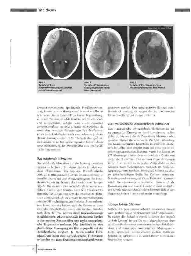 Vorschauseite 3: Überwachung und Behandlung von Patienten mitSchädel-Hirn-Trauma