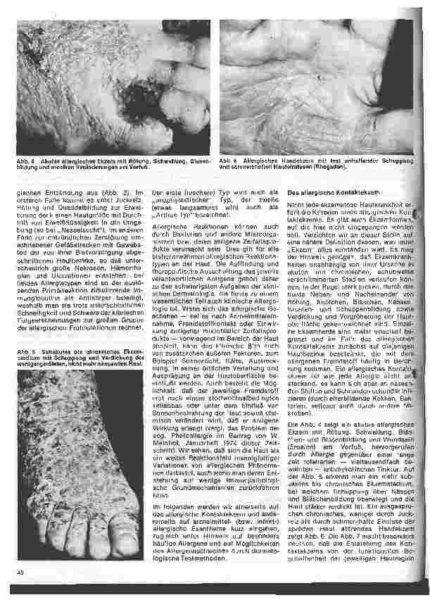 Vorschauseite 3: Arbeitsgebiete der modernen Dermatologie 3. Folge: Allergische Erkrankungen in der Dermatologie