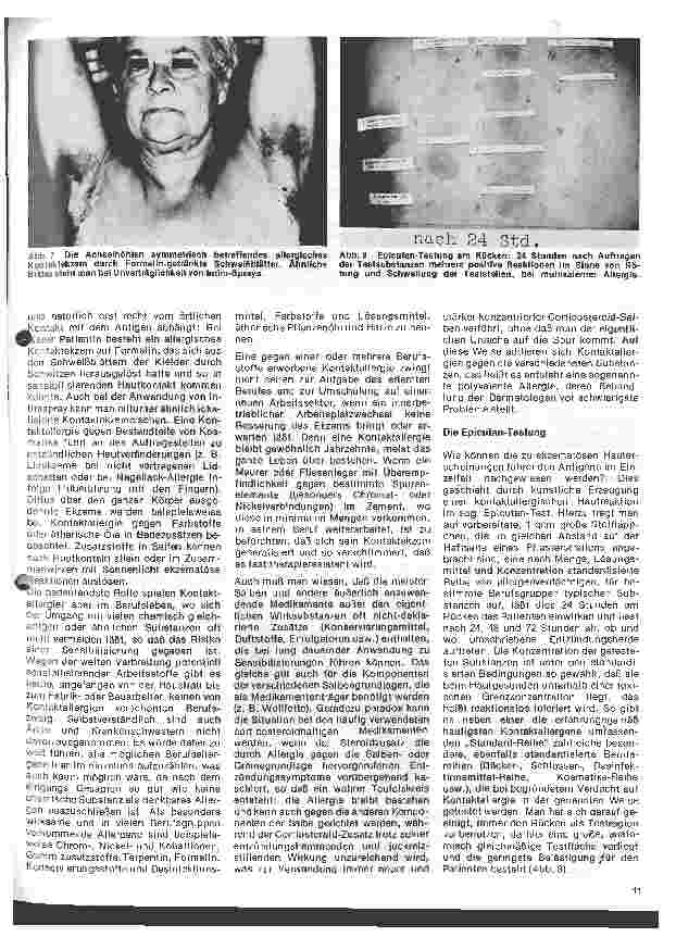 Vorschauseite 4: Arbeitsgebiete der modernen Dermatologie 3. Folge: Allergische Erkrankungen in der Dermatologie