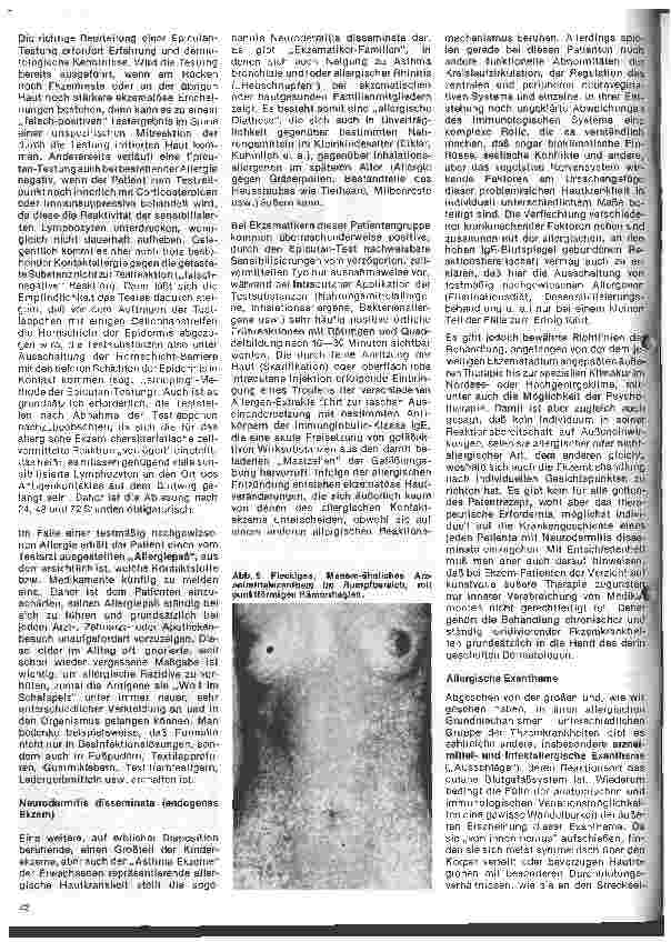 Vorschauseite 5: Arbeitsgebiete der modernen Dermatologie 3. Folge: Allergische Erkrankungen in der Dermatologie