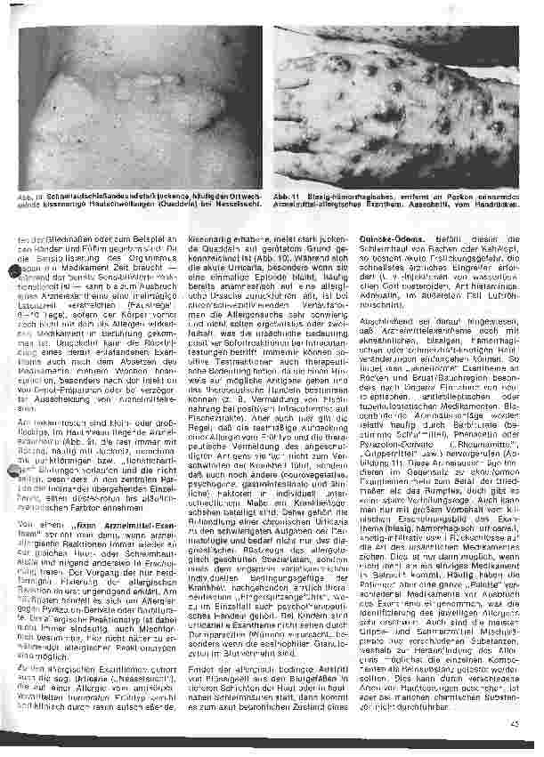 Vorschauseite 6: Arbeitsgebiete der modernen Dermatologie 3. Folge: Allergische Erkrankungen in der Dermatologie